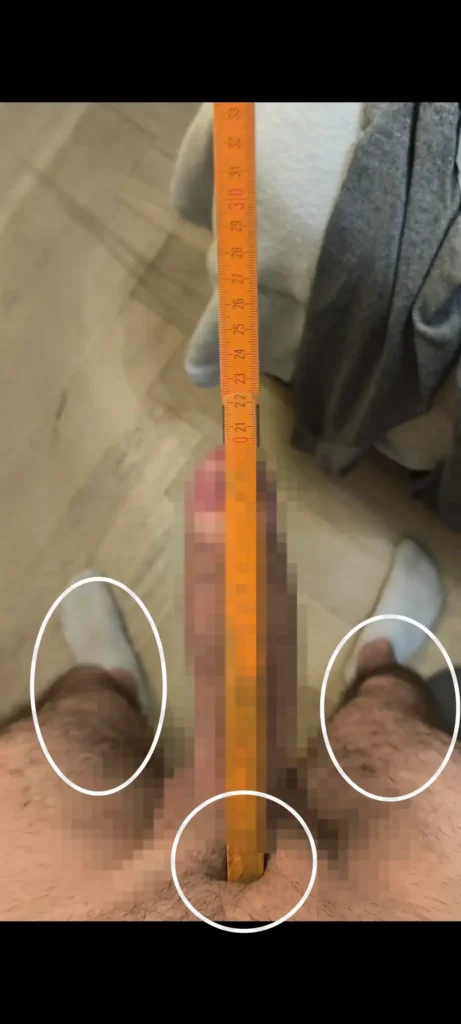 8ヶ月で＋2㎝の参考画像